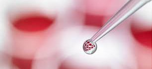 Stem Cell pic